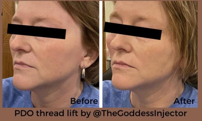 Goddess Medspa LLC