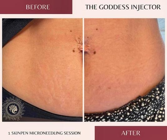 Goddess Medspa LLC