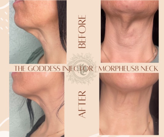 Goddess Medspa LLC