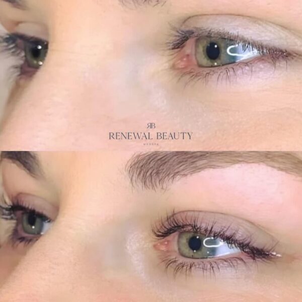 Renewal Beauty Medspa #2