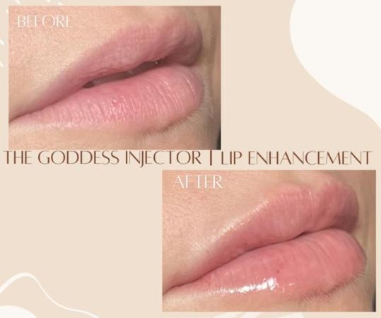 Goddess Medspa LLC #3