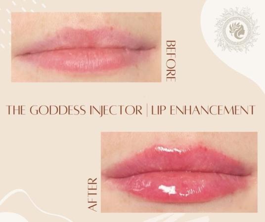 Goddess Medspa LLC #3