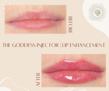 Goddess Medspa LLC #2