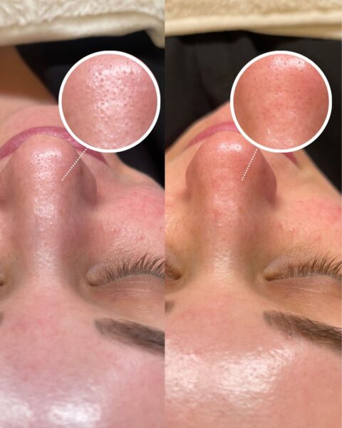 Renewal Beauty Medspa #2