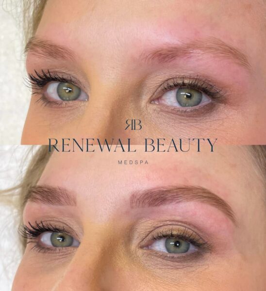 Renewal Beauty Medspa #2