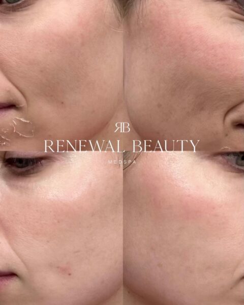 Renewal Beauty Medspa #2
